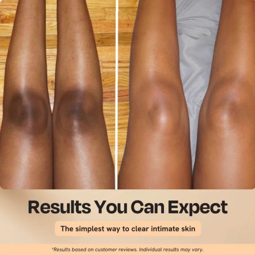 Peel Shot Keratin Care Kojic Acid Turmeric Spray