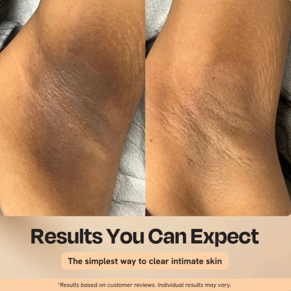 Peel Shot Keratin Care Kojic Acid Turmeric Spray