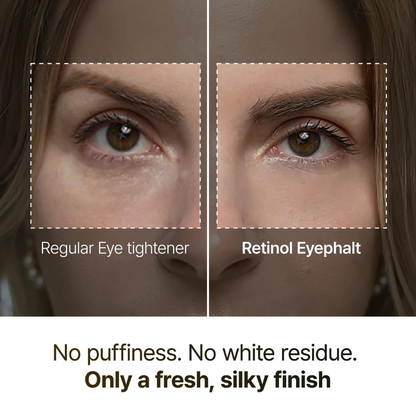 Retinol Eyebag Cream
