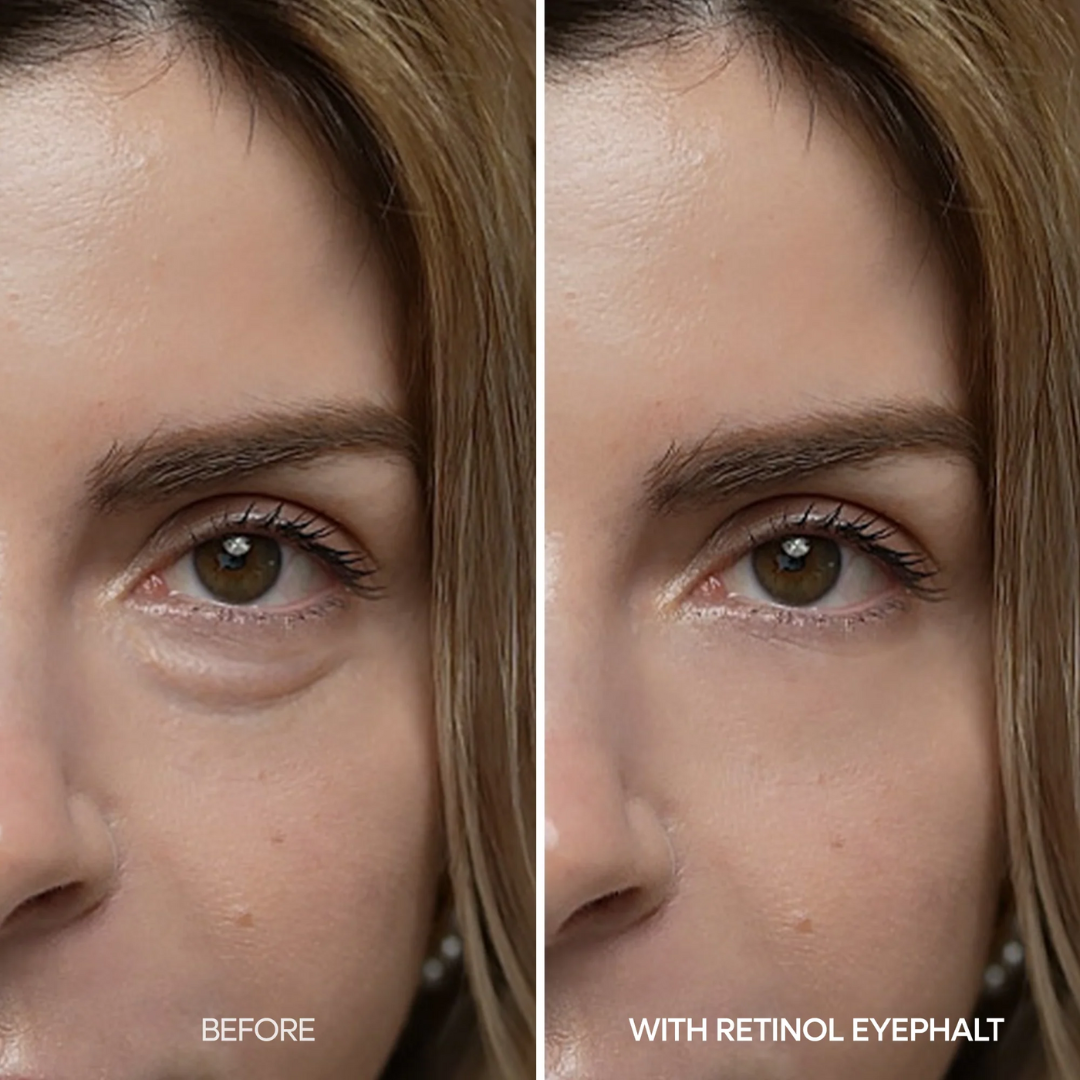 Retinol Eyebag Cream