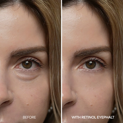 Retinol Eyebag Cream